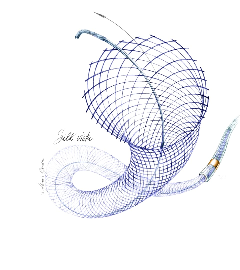 Balt Completes Enrollment in FIRST Study